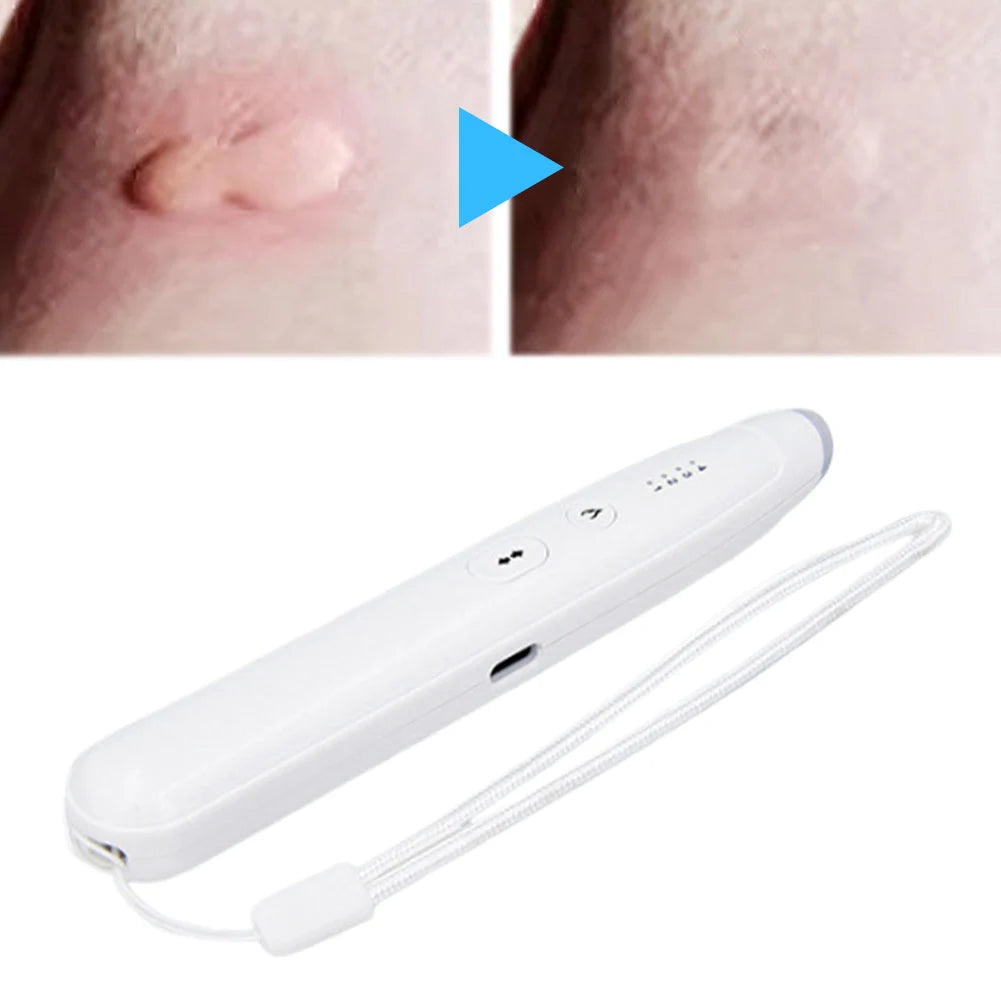Portable Mosquito Bite Magic Pen